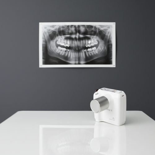 Рентген портативний Rextar(Рекстар) X New, високочастотний портативний