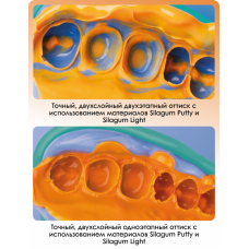 Силагум Патті Стандарт (Silagum Putty Standard) База + катал., 2х262мл